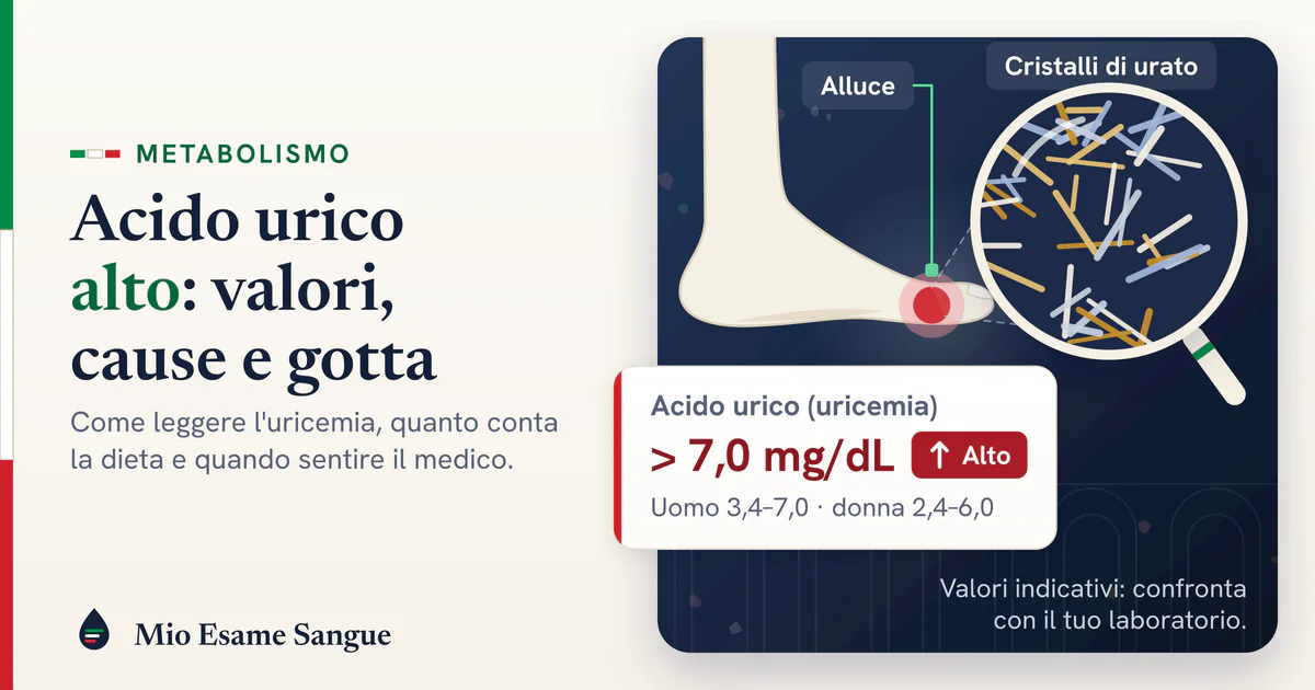 Piede di profilo con l'alluce arrossato, lente sui cristalli di urato e scheda dell'acido urico oltre 7,0 mg/dL