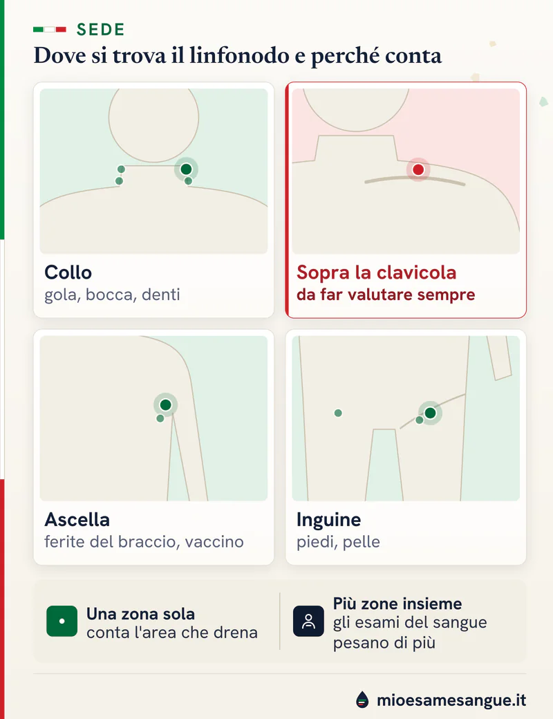 Quattro riquadri ingranditi di collo, sopra la clavicola, ascella e inguine con il linfonodo e le cause tipiche della zona