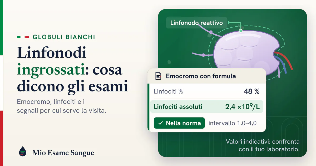 Linfonodi ingrossati: cosa dicono emocromo e linfociti Linfonodo reattivo gonfio con i suoi vasi e foglietto dell'emocromo: linfociti al 48% ma 2,4 ×10⁹/L, nella norma