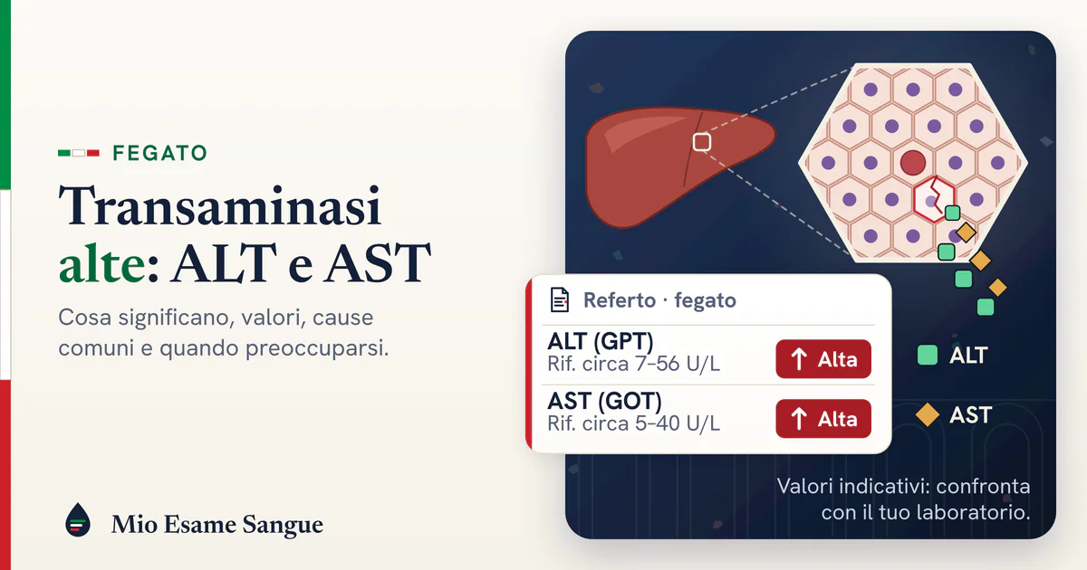 Transaminasi alte nel referto: ALT e AST sopra la norma Fegato con ingrandimento di cellule epatiche, una incrinata che libera enzimi, e referto delle transaminasi ALT e AST alte