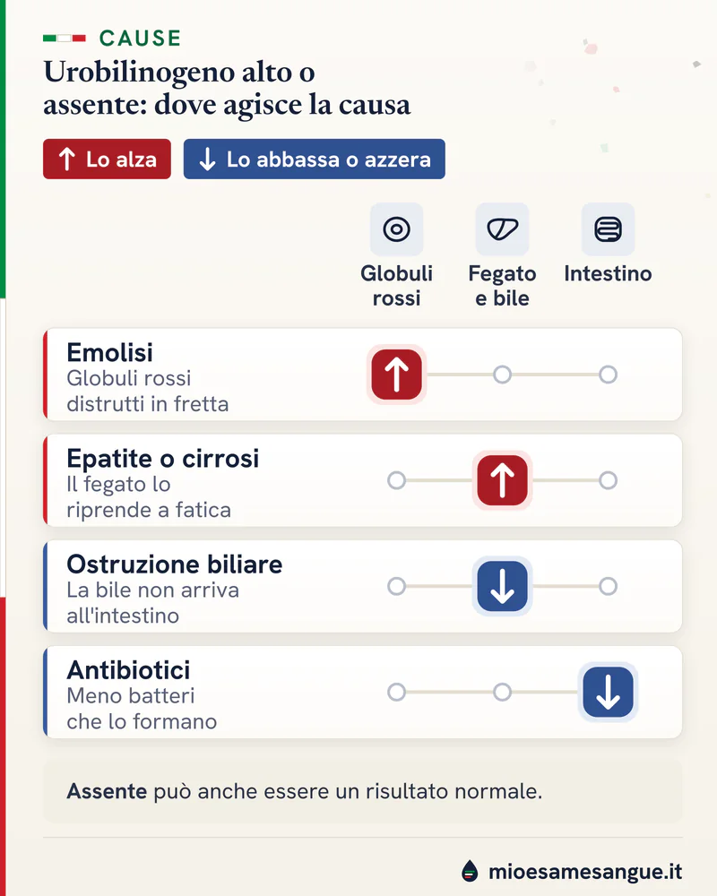 Urobilinogeno alto o assente: emolisi, epatite, ostruzione biliare e antibiotici segnati su globuli rossi, fegato o intestino