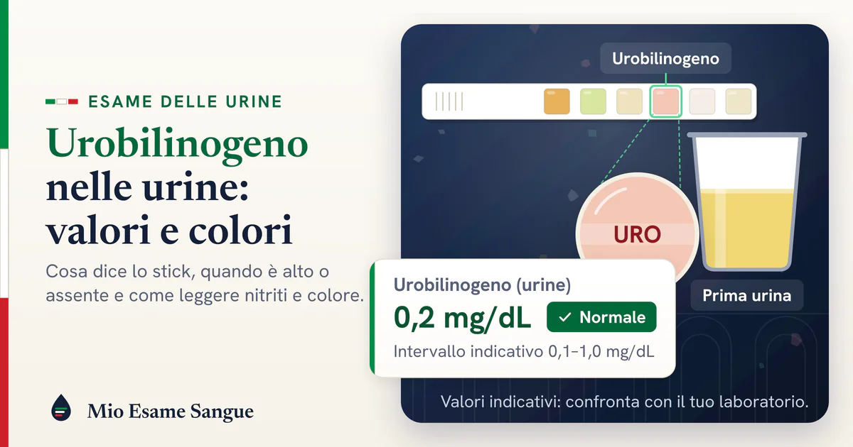 Striscia reattiva con il tampone dell'urobilinogeno sotto la lente, bicchiere di urina e scheda da 0,2 mg/dL nella norma