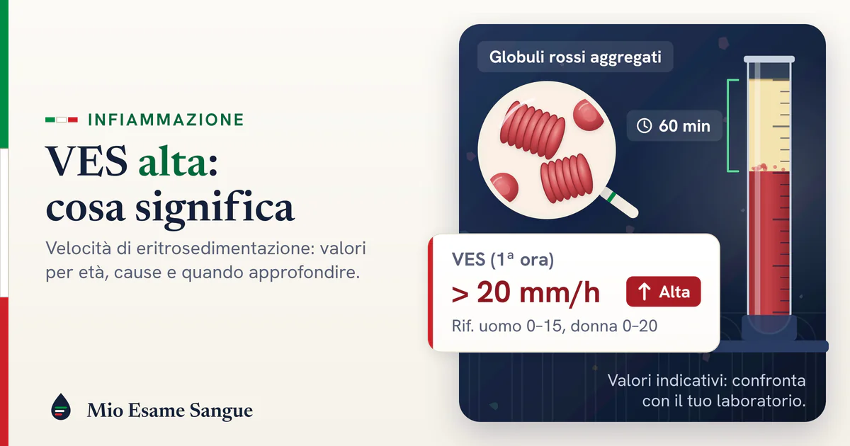 VES nel tubo di Westergren: plasma limpido sopra la colonna di globuli rossi dopo 60 minuti e scheda della VES alta